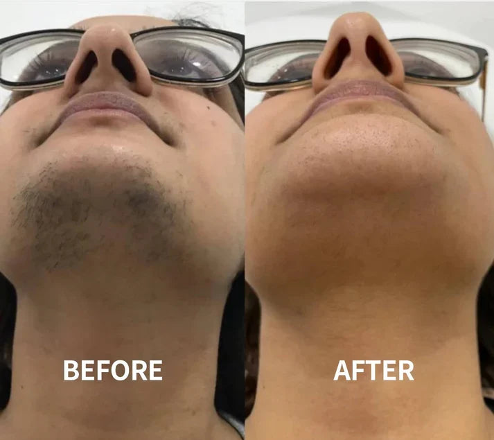 🔥Gentle and Painless Facial Hair Removal Cream
